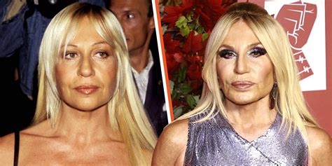 what did donatella versace do to her face|Donatella Versace then and now.